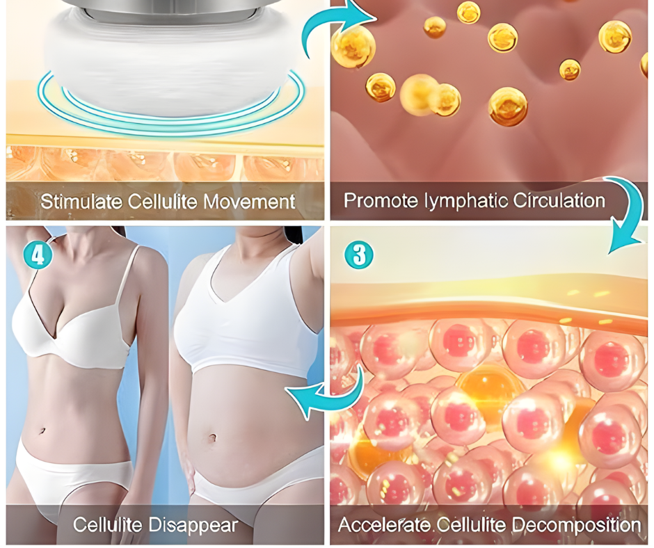 SculpFlex Pro™- Body sculpting Cellulite Massager